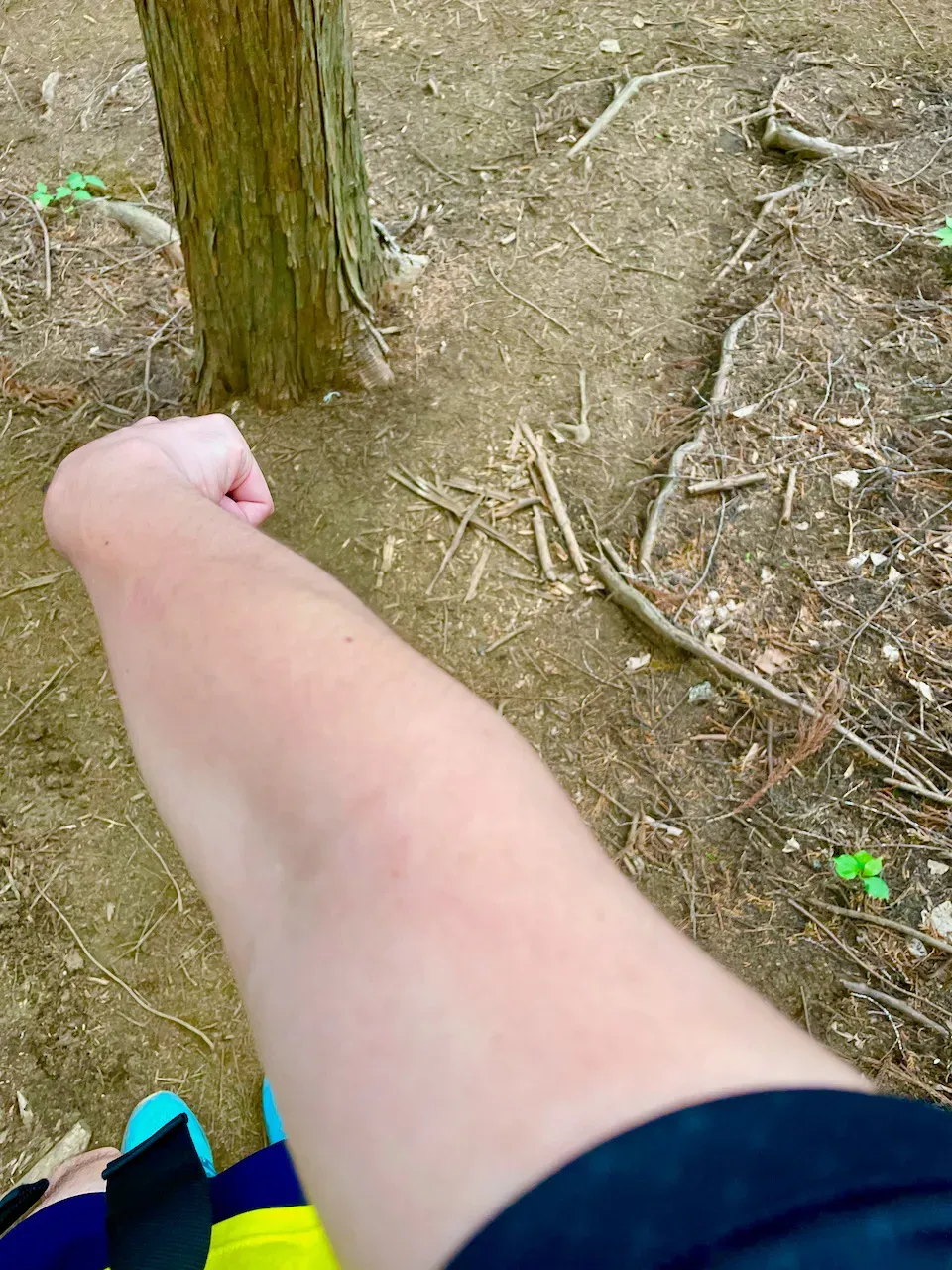 高尾山から陣馬山へトレランしたけど、笹？にかぶれて手足がかゆい！ - 画像13