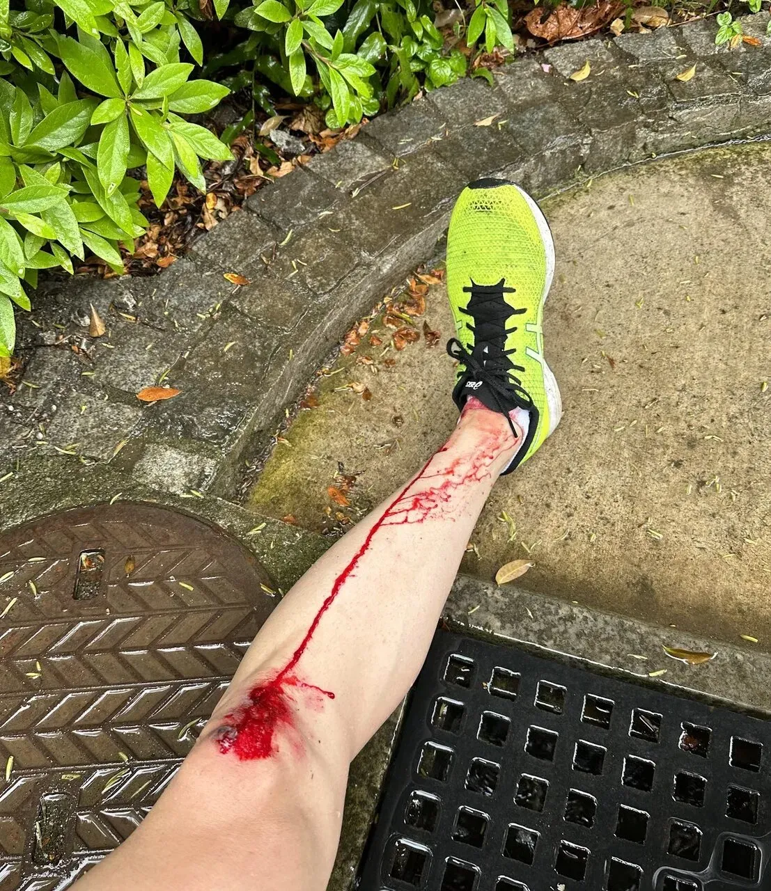 擦り傷に”エアウォール”が良い！キズパワーパッドの1/7ぐらいのコスト - 画像4