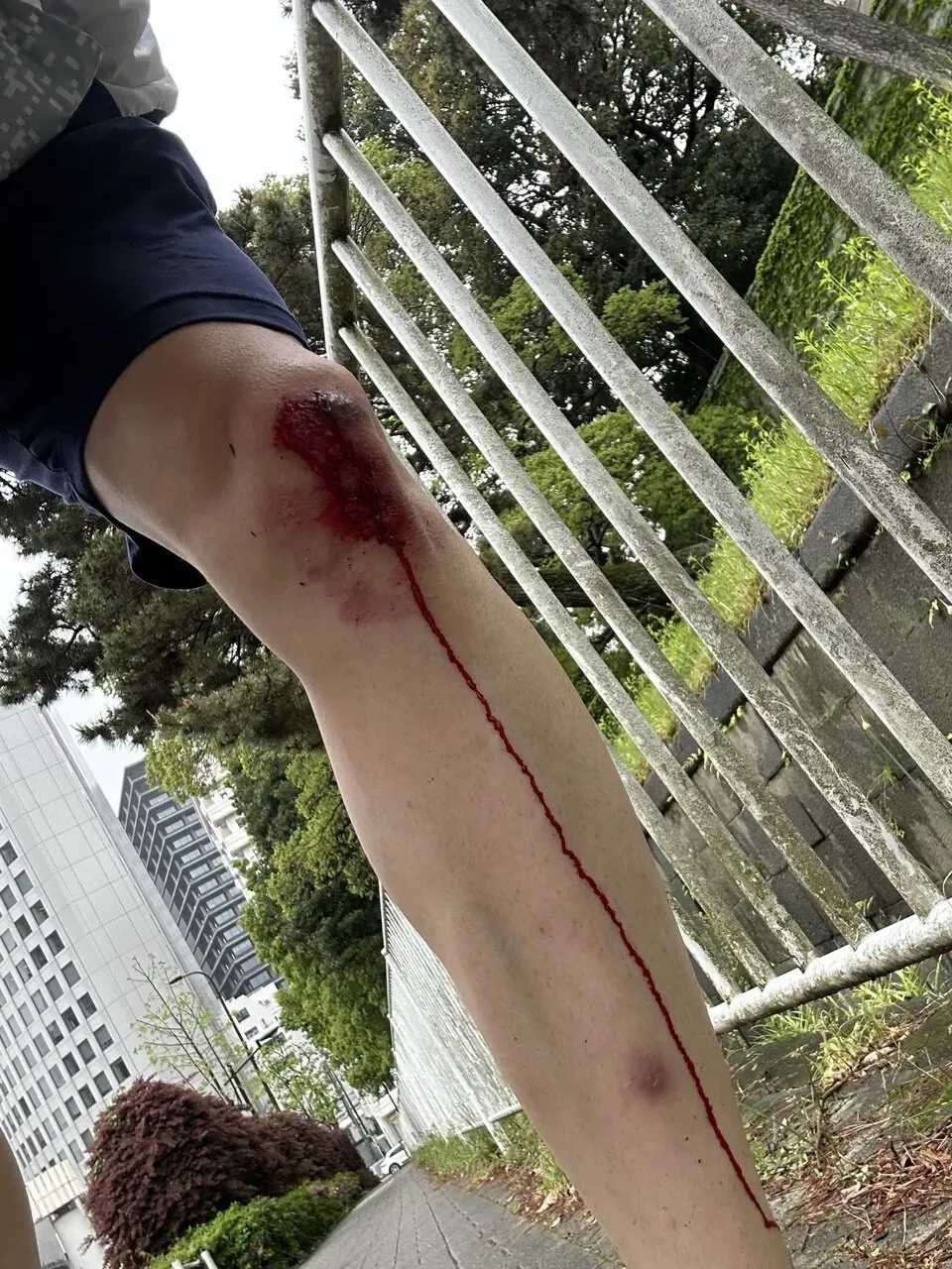 擦り傷に”エアウォール”が良い！キズパワーパッドの1/7ぐらいのコスト - 画像3